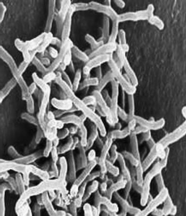 Bifidobacterium infantis