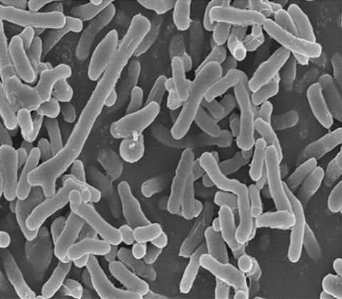 Bifidobacterium longum
